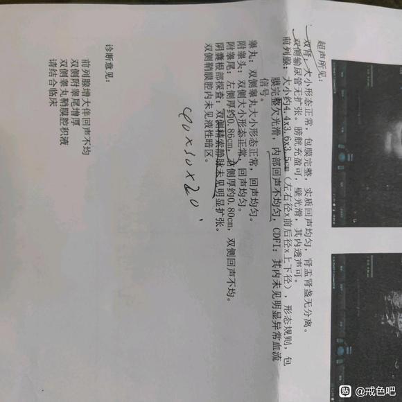 ”请问有和我一样的前例腺炎的吗？帮我看看我这到底严重不严重