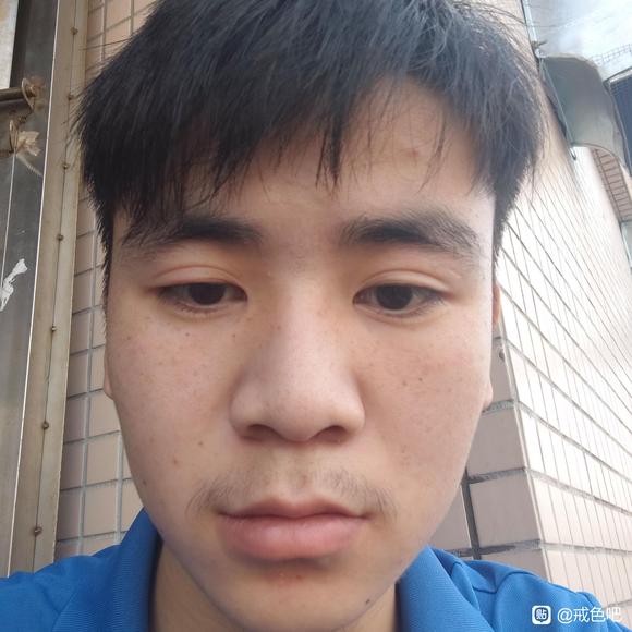 ”各位吧友帮我看看严不严重