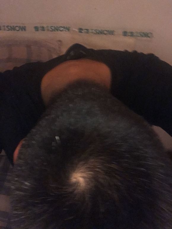 ”19撸了四年，sy导致现在掉头发，社交恐惧，身高也165哎真