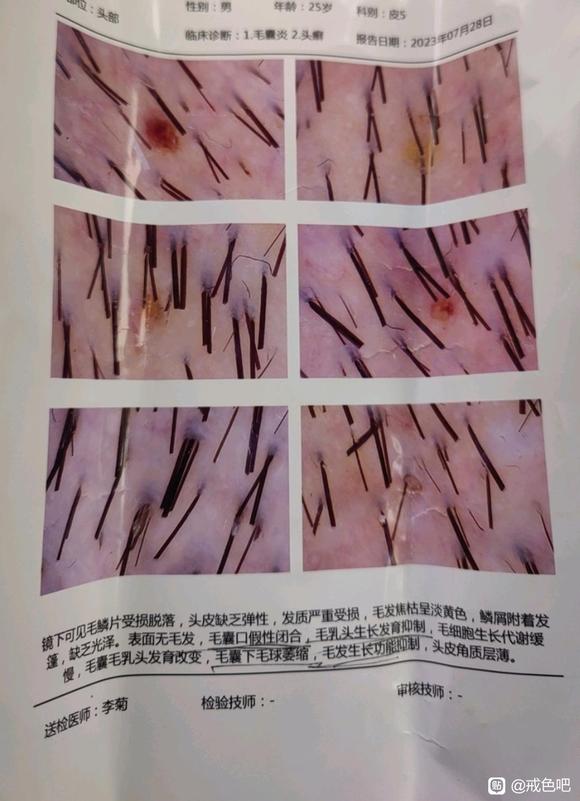 ”头发问题，懂的师兄