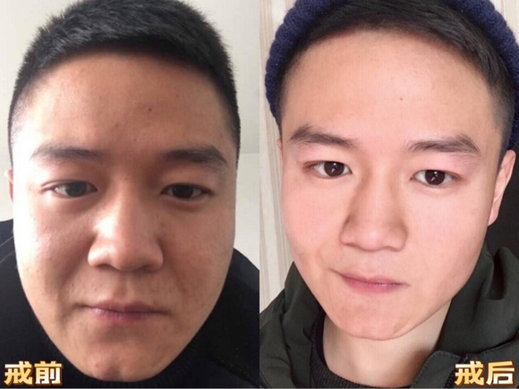 ”如何解决出大量出汗的问题？