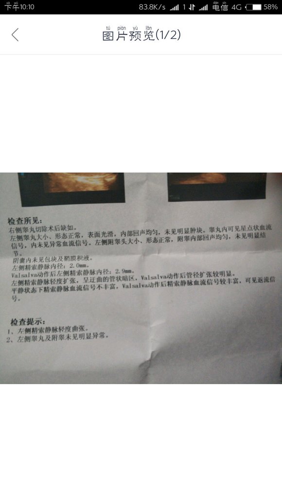 ”希望你们能骂我，我真的太不爱惜自己了，