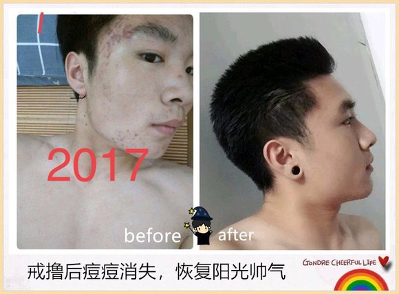 ”戒色恢复对比图，丑小鸭变天鹅！