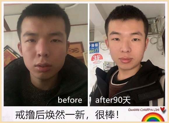 ”戒色恢复对比图，丑小鸭变天鹅！