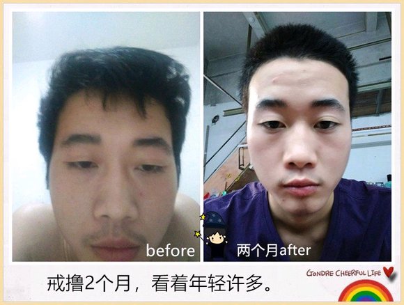 ”戒色恢复对比图，丑小鸭变天鹅！