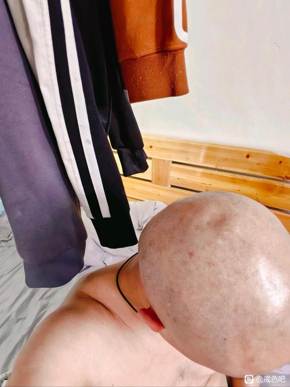 ”#微信看病卖药是假的#求各位戒友给点意见。