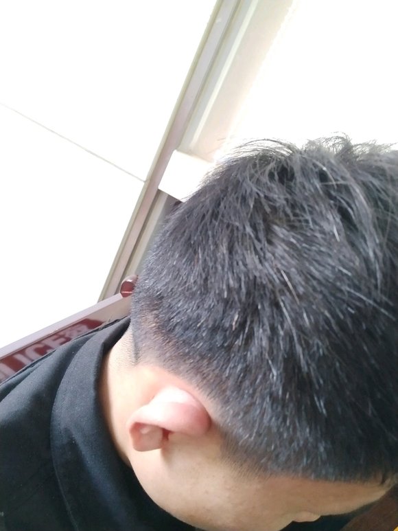 ”我戒了很长时间了。还吃七宝美髯丹治白发的。为什么还不好。一点