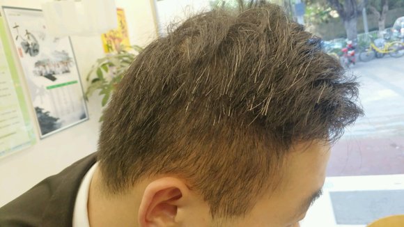 ”戒色养生100天，有阳痿早泄，掉发，白发肾虚的兄弟们可以一起