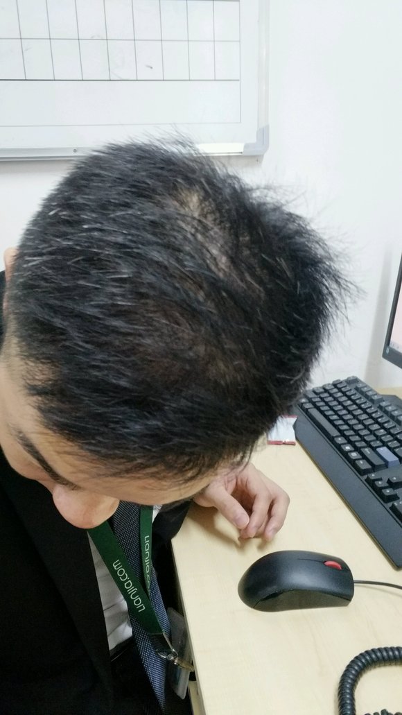 ”戒色养生100天，有阳痿早泄，掉发，白发肾虚的兄弟们可以一起