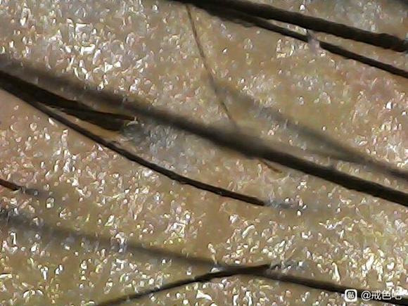 ”头发变细了，还能恢复