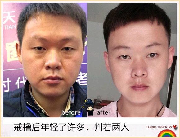 ”戒色对比恢复图之变成真正的男人！