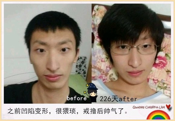 ”戒色对比恢复图之变成真正的男人！