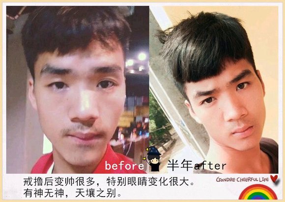 ”戒色对比恢复图之变成真正的男人！