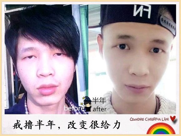 ”戒色对比恢复图之变成真正的男人！