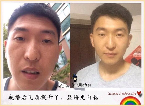 ”戒色对比恢复图之变成真正的男人！