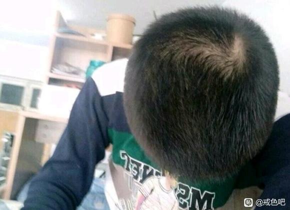 ”戒se半年，头发的变化！(转载)