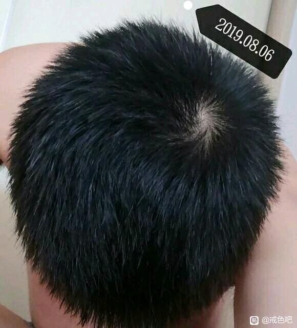 ”戒se半年，头发的变化！(转载)