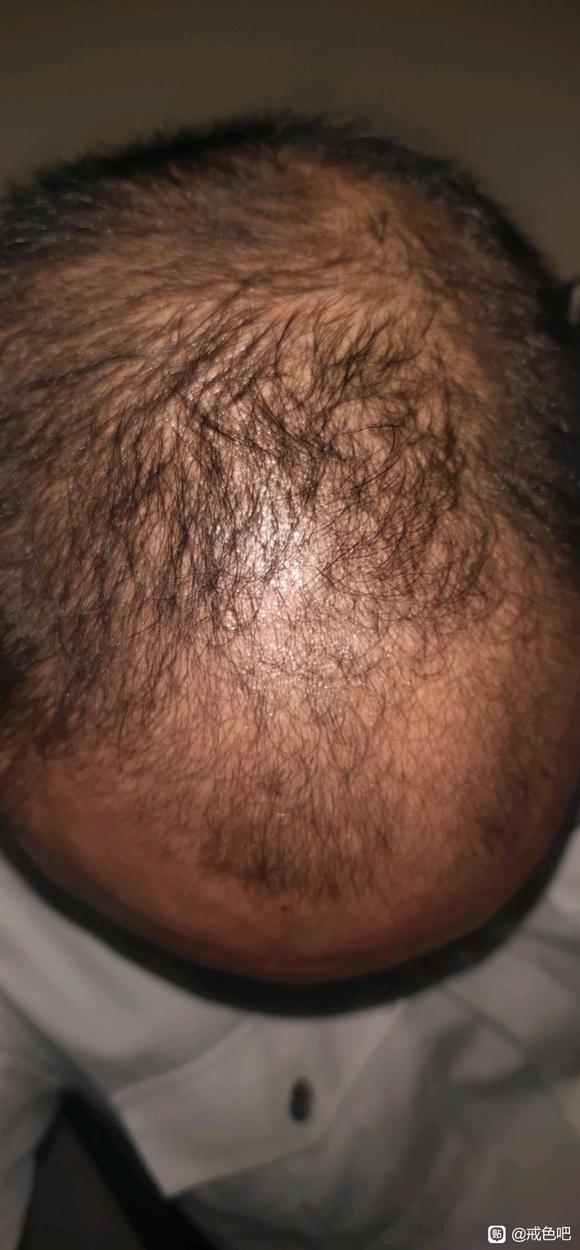 ”请师兄们，帮帮我，帮我分析分析好吗，真的目前的我失去了许多许多