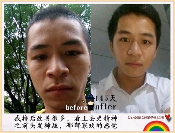 ”戒色恢复对比图之青蛙变王子