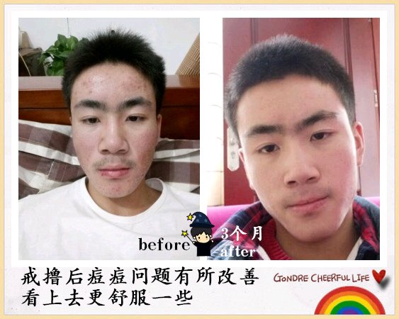 ”戒色恢复对比图之青蛙变王子