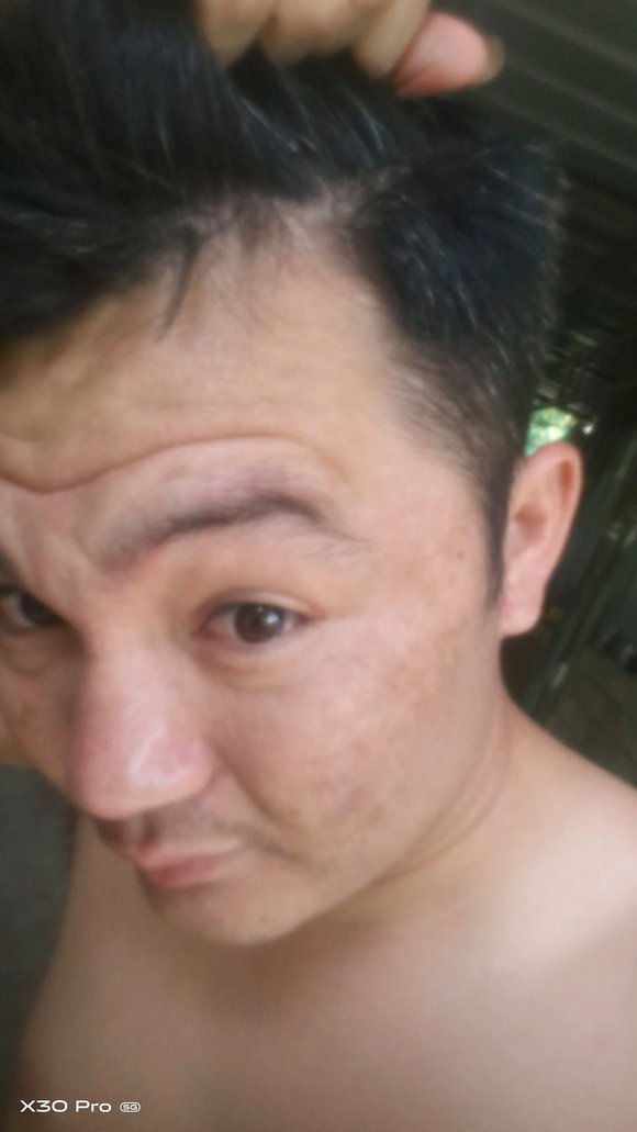 ”30岁的面相，手淫十多年，现在什么都没有，一身病