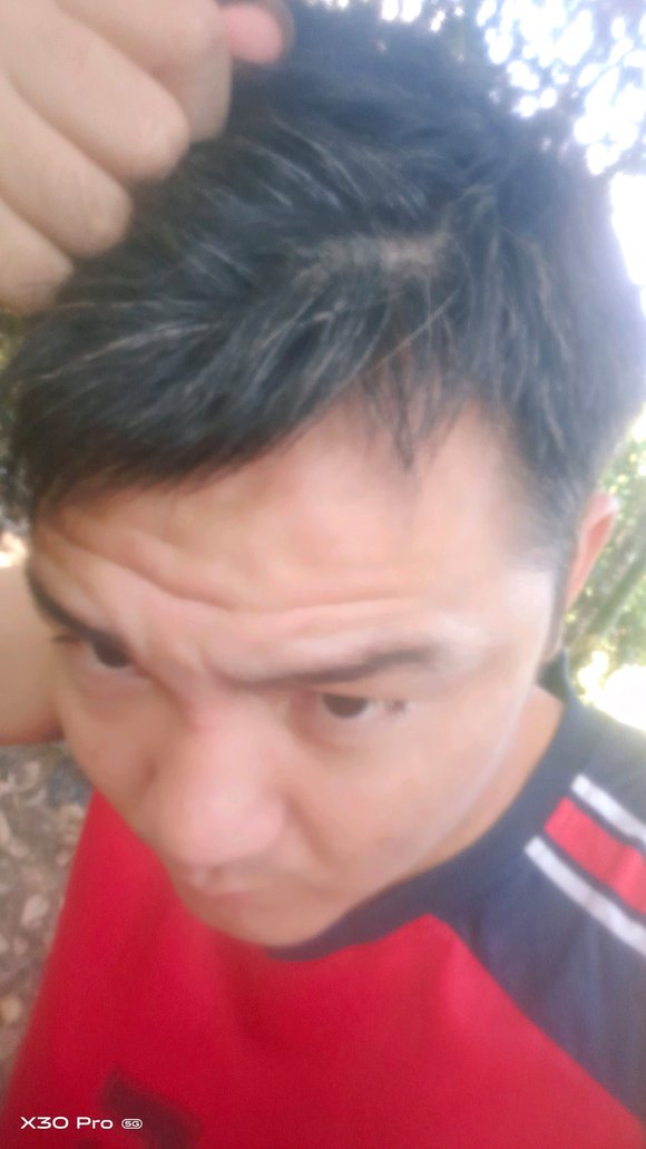 ”30岁的面相，手淫十多年，现在什么都没有，一身病