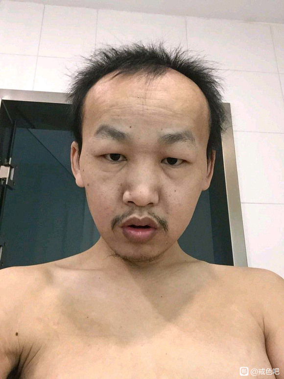 ”兄弟们，今年24了，但是一副肾虚无精打采的样子，而且还脱发，