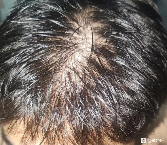 ”还有救吗.....