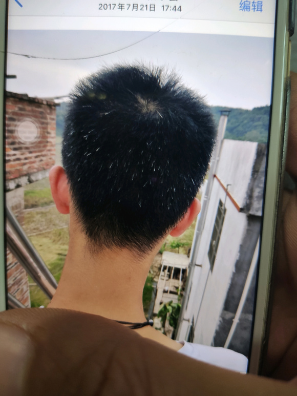 ”白发是可以恢复的!!