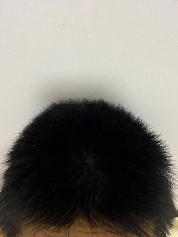 ”有sy导致肾虚再导致白发的吧友吗？有什么养发经验可以分享吗。