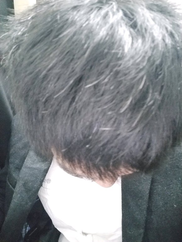 ”白头发，戒多久能恢复？