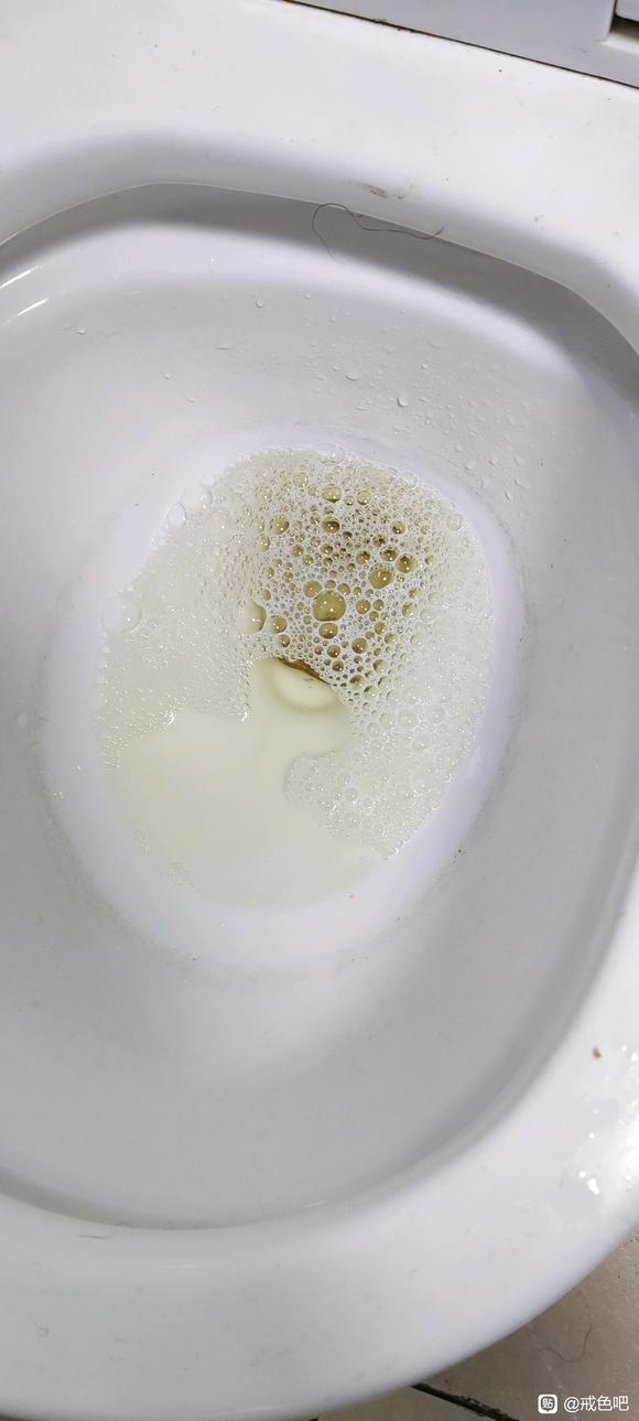 ”xy导致泡沫尿，很担心