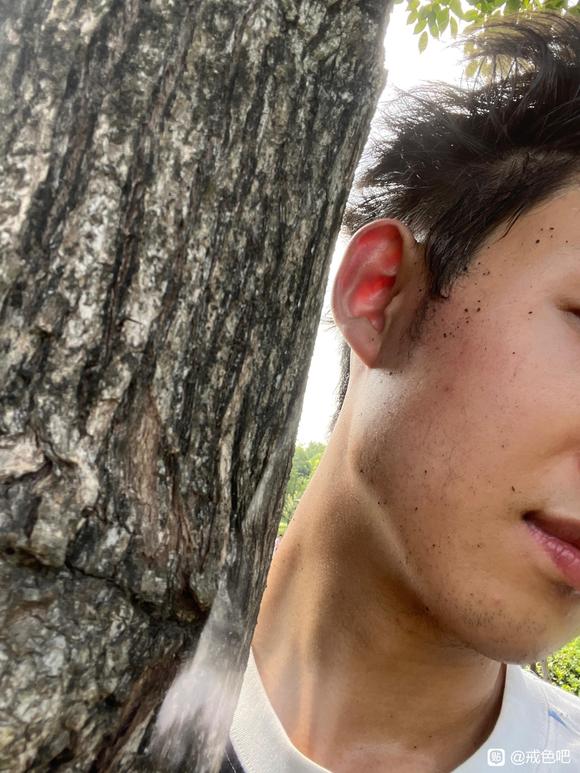 ”第一次树疗，有点社死