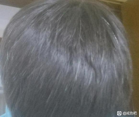 ”想问问白发还能恢复吗