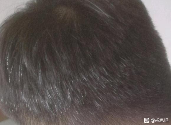 ”想问问白发还能恢复吗