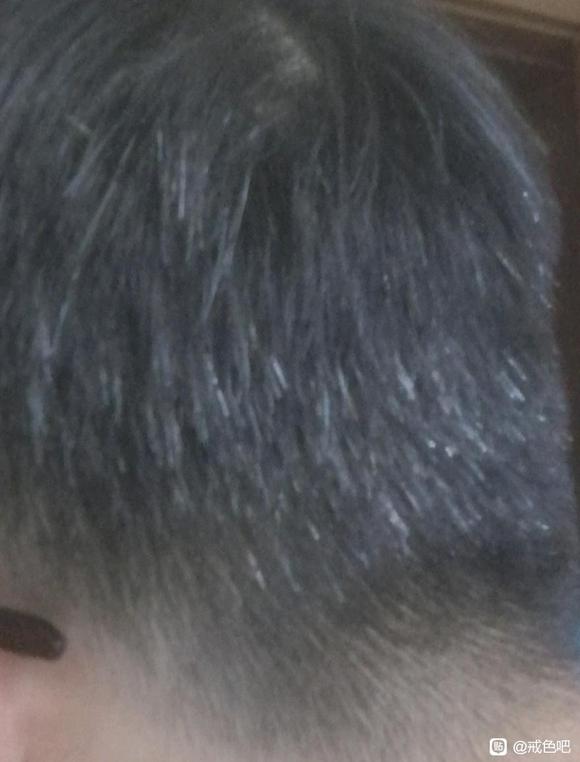 ”想问问白发还能恢复吗