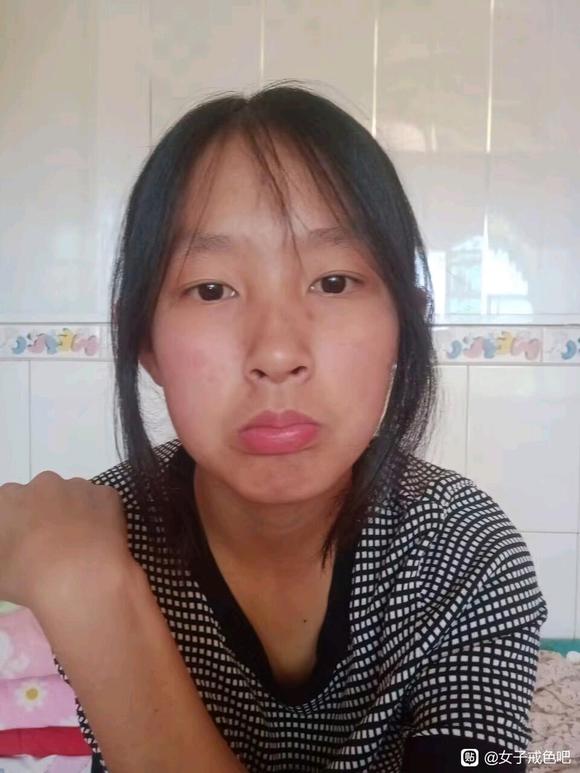 ”姐姐们，可以帮我看一下有什么症状吗