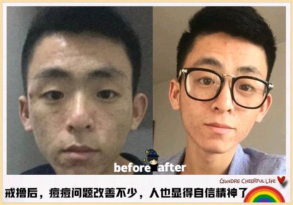 ”戒色恢复对比图：男人最好的化妆品