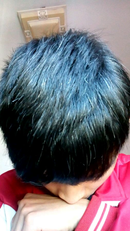 ”【问题求助】我的白发！淫邪已戒！！但是白发太影响外表了！特别烦