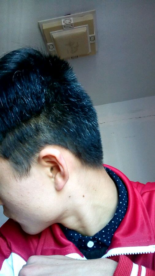 ”【问题求助】我的白发！淫邪已戒！！但是白发太影响外表了！特别烦