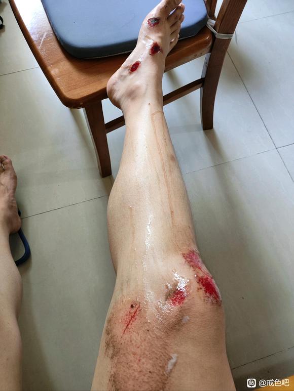 ”分享个人经历，大家引以为戒。