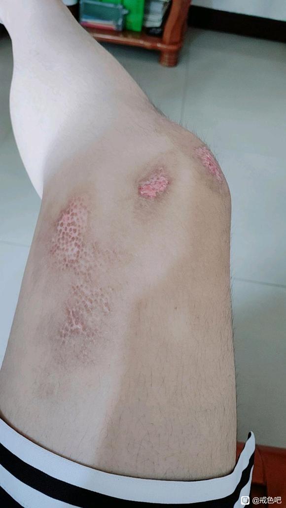 ”分享个人经历，大家引以为戒。