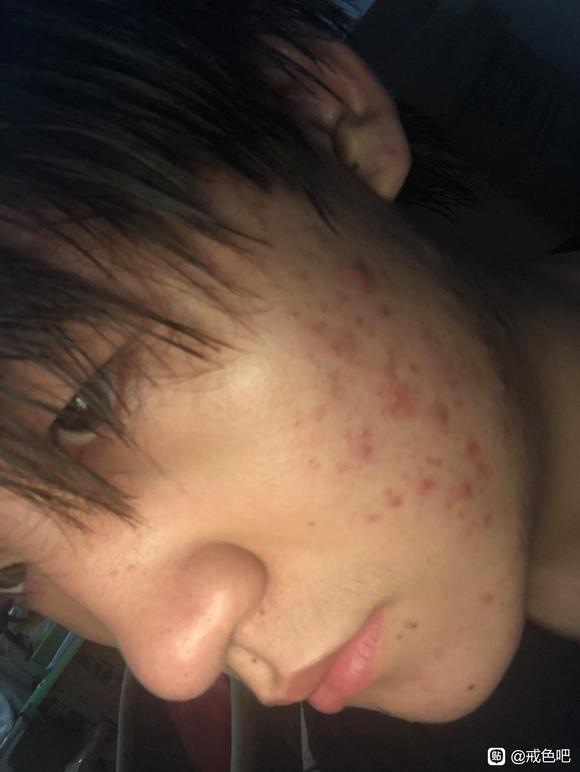 ”给大伙看一下戒色的对比照片