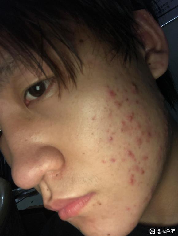 ”给大伙看一下戒色的对比照片