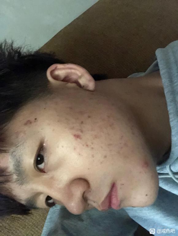 ”给大伙看一下戒色的对比照片