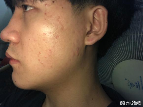 ”给大伙看一下戒色的对比照片