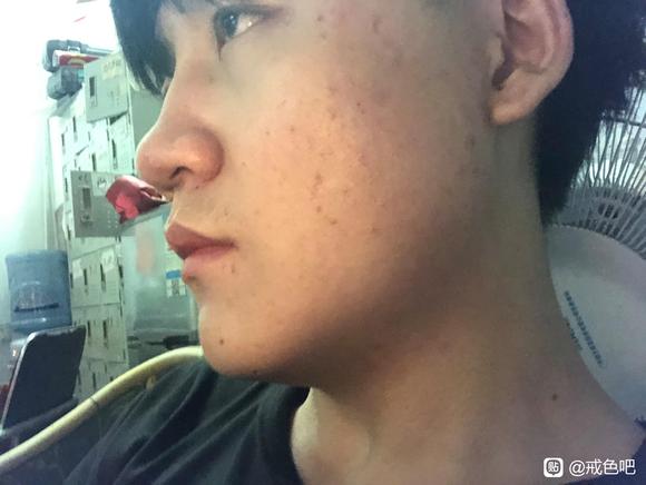 ”给大伙看一下戒色的对比照片