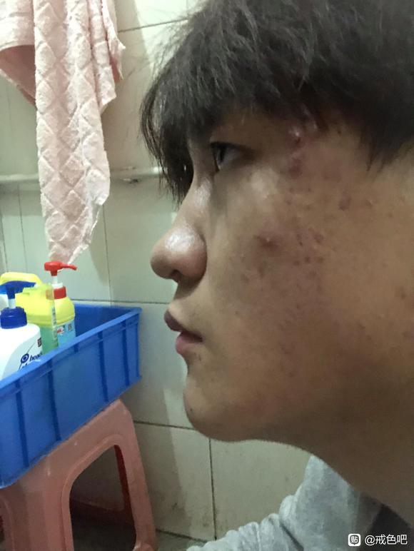 ”给大伙看一下戒色的对比照片