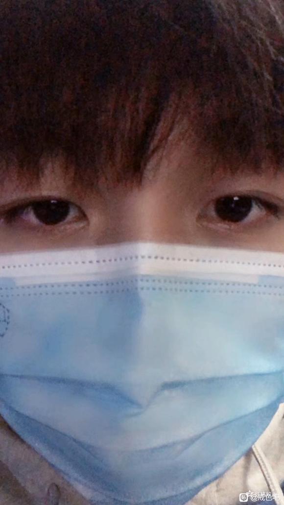 ”给大伙看一下戒色的对比照片