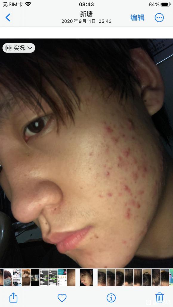 ”给大伙看一下戒色的对比照片